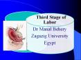 Third stage of labor for undergraduate