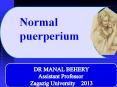 Puerprium ,puerpral fever ,and puerpral sepsis for undergraduate