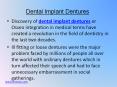 Dental Implant Dentures 12-17