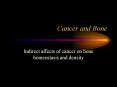 Cancer and Bone Indirect affects of ... bone resorption Wor