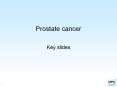 Prostate cancer Key slides Diseases of the prostat