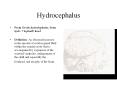 Hydrocephalus From Greek hydrokephalos, from hydr- + kephal
