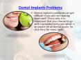 Dental Implants Problems