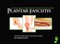 Plantar Fasciitis Information And Treatment