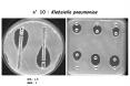 n 10 : Klebsiella pneumoniae AMC AMC AMC CAZ CAZ CAZ FEP FE