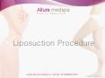 Liposuction | Affordable Liposuction Cost in Mumbai, India.