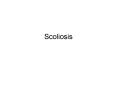 Scoliosis Scoliosis Scoliosis is defined as an abnorma
