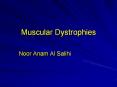 Muscular Dystrophies Noor Anam Al Salihi Muscula