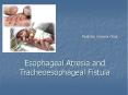 Pediatric Surgery Clinic Esophageal Atresia an