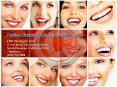 Dental Implants California |Dental Implants Pasadena