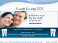 Susan Leung DDS, Affordable Cosmetic Dentistry