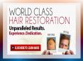 Cost For Hair Transplant