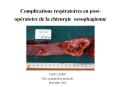 Complications respiratoires en post-op ratoire de l