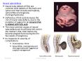 Neural tube defects Neural tube defects (NTDs) are commo