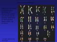 Chromosomes and Inheritance Since genes are carried o