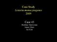 Case Study Listeria monocytogenes 2009 Case 43 Roubin
