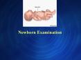 Newborn Examination * * * * * * * Crouzon,s: brachycephali