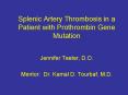 Splenic Artery Thrombosis in a Patient with Prothrombin Gen