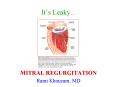 It s Leaky... MITRAL REGURGITATION Rami Khouzam, MD Mitra