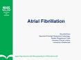 Atrial Fibrillation Steve McGlynn Specialist Principa