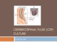 CEREBROSPINAL FLUID (CSF) CULTURE D. M. M. Lab. CSF cultur
