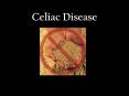 Celiac Disease Gluten-free foods can either be naturall