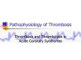 Pathophysiology of Thrombosis Thrombosis and Thrombolysis i