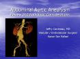 Abdominal Aortic Aneurysm Review and Radiologi