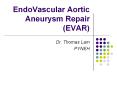 EndoVascular Aortic Aneurysm Repair (EVAR) Dr. Thomas La