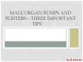 Male Organ Bumps and Blisters – Three Important Tips