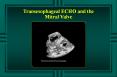 Transesophageal ECHO and the Mitral Valve Fibrous Skeleto