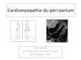 Cardiomyopathie du p ri-partum Denis DOYEN 2 me ann e DESC 