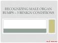 Recognizing Male Organ Bumps – 3 Benign Conditions