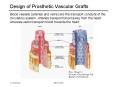 Design of Prosthetic Vascular Grafts