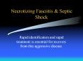 Necrotizing Fasciitis