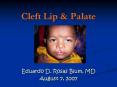 Cleft Lip