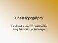 Chest topography