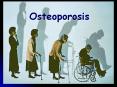 Osteoporosis