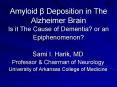 Amyloid Deposition in The Alzheimer Brain Is it The Cause of Dementia or an Epiphenomenon