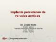 Implante percutaneo de valvulas aorticas