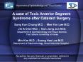A case of Toxic Anterior Segment Syndrome after Cataract Surgery