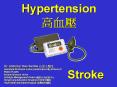 Hypertension