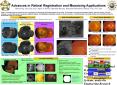 A montagebuilding algorithm is developed to eliminate image boundaries, illumination artifact, and t