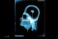 Radiation Kilo Curie