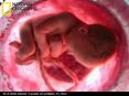 El Aborto