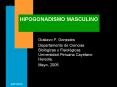HIPOGONADISMO MASCULINO