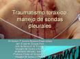 Traumatismo torxico manejo de sondas pleurales
