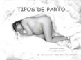 TIPOS DE PARTO
