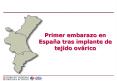 Primer embarazo en Espaa tras implante de tejido ovrico