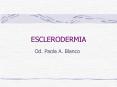 ESCLERODERMIA